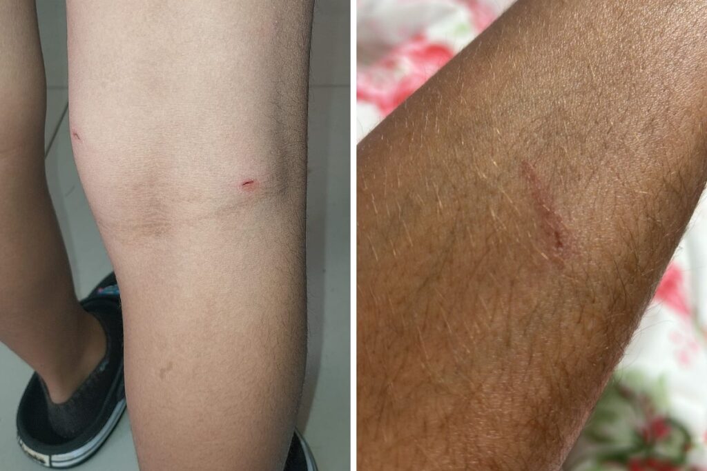 cão que invadiu escola municipal em Nova Odessa Arquivo pessoal Um cachorro inva