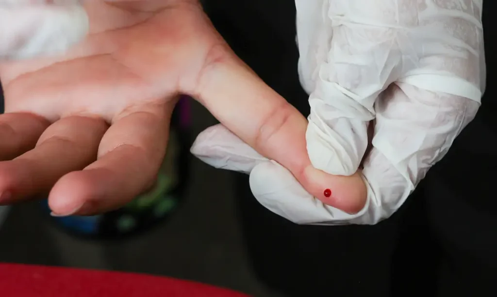 Hepatite B: Brasil alcança marco histórico na eliminação da transmissão vertical do vírus