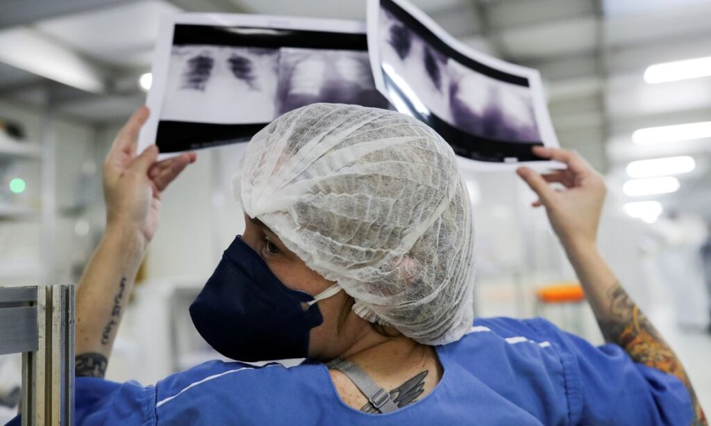 Milhares de pacientes com câncer de pulmão recebem diagnóstico tardio no SUS