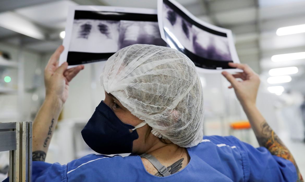 Milhares de pacientes com câncer de pulmão recebem diagnóstico tardio no SUS