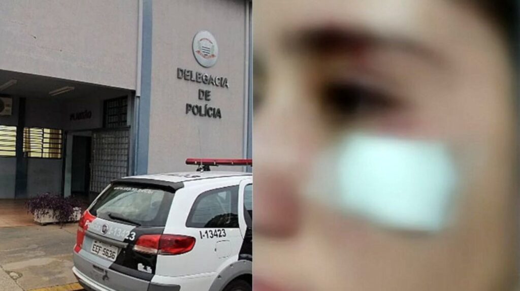 Violência doméstica registra dois casos graves de agressão no interior paulista