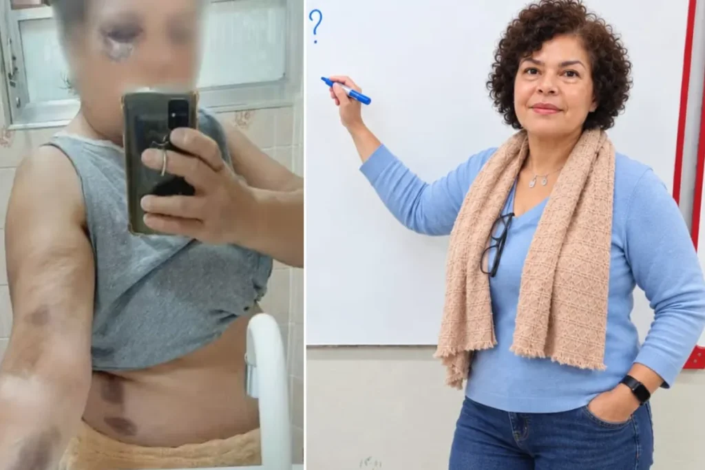 Indenização de R$ 5 mil por agressão a professora em Cubatão é considerada 'irrisória' pela vítima