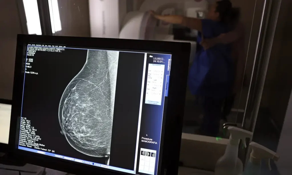 Guia lançado por entidades médicas orienta preenchimento para barrar negativa de mamografia digital por planos
