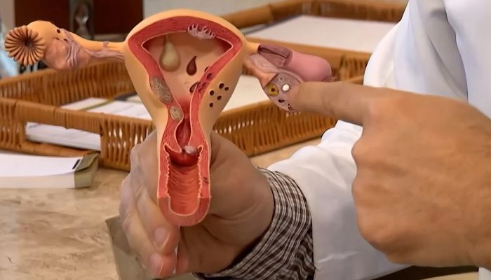 Endometriose: R$ 60 milhões em nova chamada para pesquisas e soluções no SUS