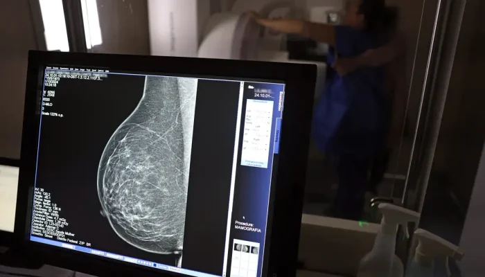 Guia lançado por entidades médicas orienta preenchimento para barrar negativa de mamografia digital por planos