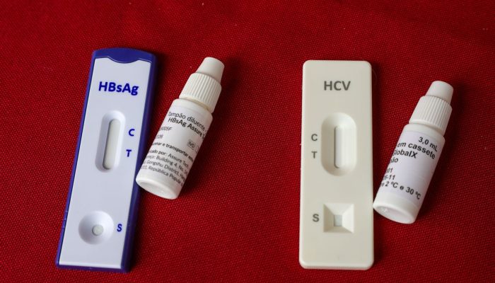 Hepatites virais: Julho Amarelo e o Dia Mundial de Luta reforçam a urgência do diagnóstico precoce