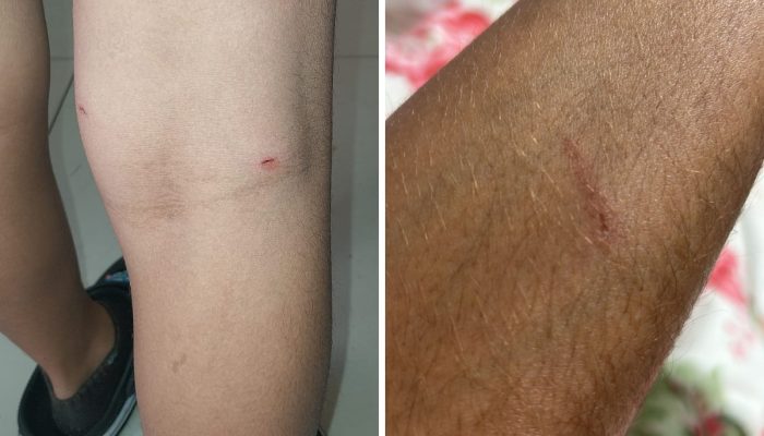 cão que invadiu escola municipal em Nova Odessa Arquivo pessoal Um cachorro inva