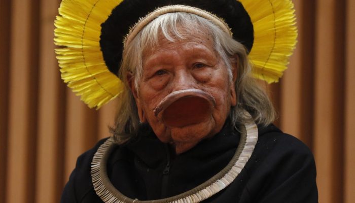 Cacique Raoni apresenta melhora após cirurgia e segue estável em São Paulo