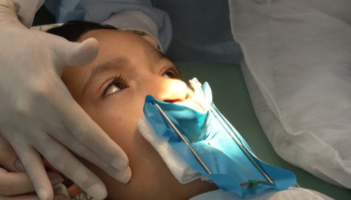 Diagnóstico precoce e equipe multidisciplinar são cruciais no tratamento da fissura labiopalatina