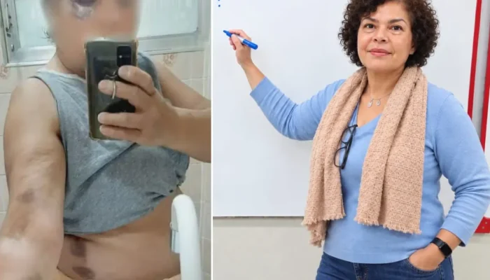 Indenização de R$ 5 mil por agressão a professora em Cubatão é considerada 'irrisória' pela vítima
