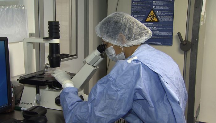 Remissão do HIV: novos casos com transplante de células-tronco reacendem esperança na ciência
