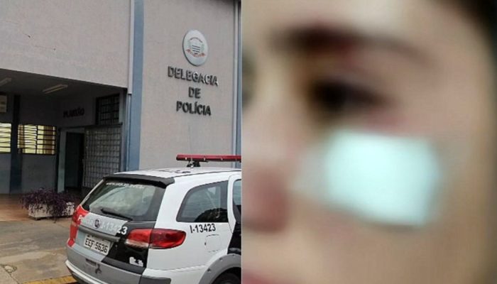 Violência doméstica registra dois casos graves de agressão no interior paulista